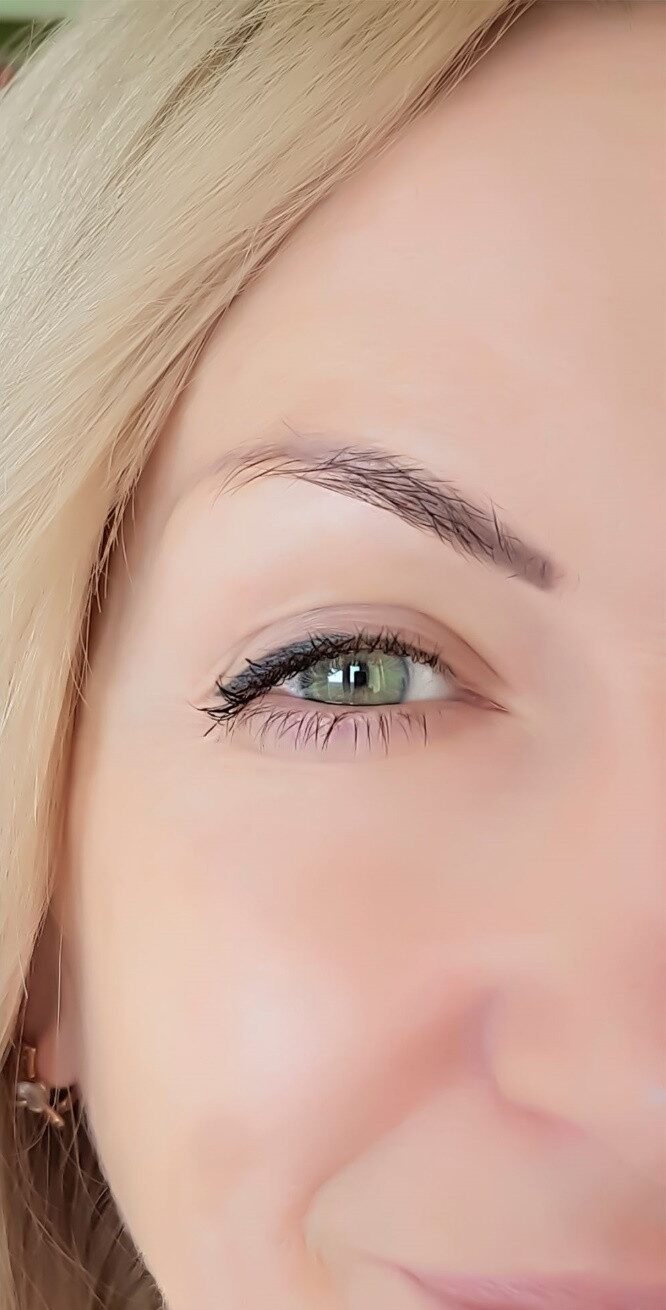 before-and-after-anit-wrinkle-woodstock-clinic